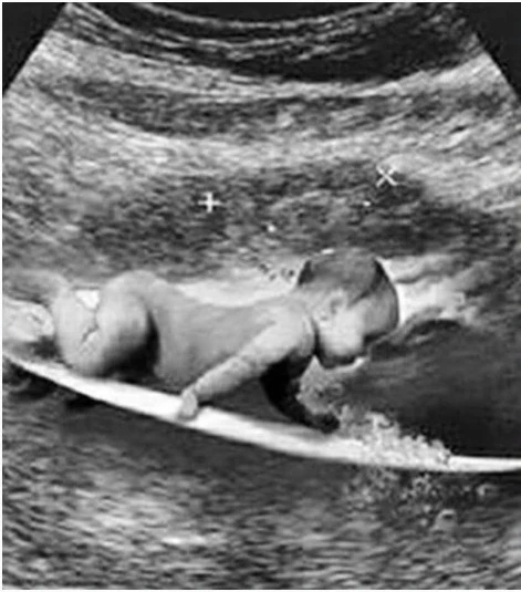 Imagem do comunicado divulgado pelo surfista.