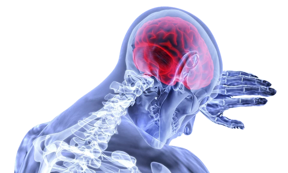 Acidente vascular cerebral deve ser atendido em unidades de saúde especializadas.