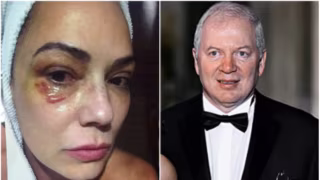 Luiza Brunet cobra R$ 1 milhão de Lírio Parisotto por agressões