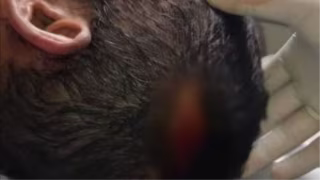 Pedreiro é agredido com facão quando trabalhava em obra; suspeito foi preso