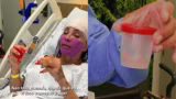 Maya Massafera revela detalhes de cirurgia facial para harmonizar rosto