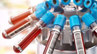 Estudo indica novos exames para prever risco cardíaco além do colesterol