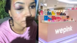 Funcionária agredida na WePink se pronuncia pela primeira vez e pede justiça
