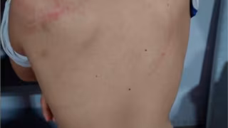 Mãe é presa por agredir a filha de 6 anos com mangueira por não conseguir fazer dever de casa em MG