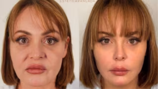 Gaby Spanic surpreende fãs ao exibir visual renovado após procedimentos estéticos