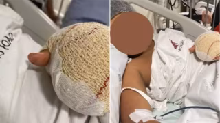 Menino brasileiro tem dedos amputados após possível caso de racismo em escola de Portugal