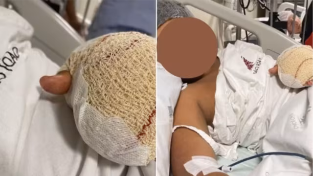 Menino brasileiro tem dedos amputados após possível caso de racismo em escola de Portugal