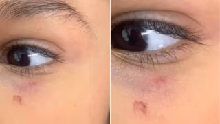 Mãe denuncia suposta agressão de professora contra filho de 6 anos em escola de Praia Grande