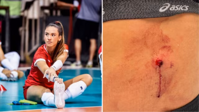 Atleta profissional de vôlei do Tijuca é baleada em tentativa de assalto na Tijuca