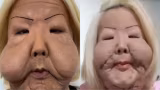 Após 10 dias sumida, Juju do Pix mostra resultado de 1ª etapa de reconstrução facial