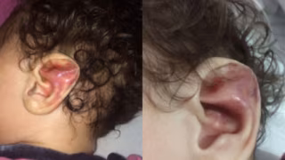 Mãe acusada de torturar filha e quebrar seis costelas é presa