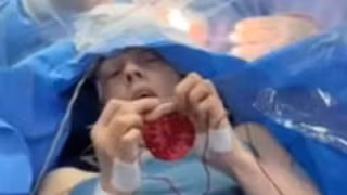 Agricultora faz crochê enquanto passa por cirurgia de tumor cerebral acordada no Paraná