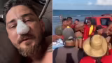 Empresário agredido em Porto de Galinhas passa por cirurgia após quatro fraturas no rosto