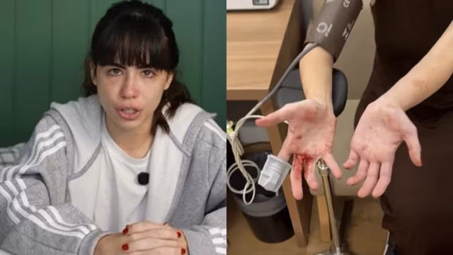 Atriz Nina Baiocchi sofre assalto em carro de app em São Paulo e fica ferida por estilhaços