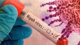 Surto de vírus Nipah na Índia acende alerta, mas risco de chegada ao Brasil no Carnaval é considerado baixo
