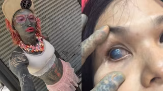 Tatuadora alemã faz intervenção com tinta no globo ocular de tailandesa e caso viraliza