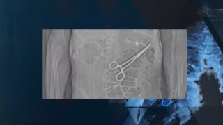 Erros graves em cirurgias no Brasil levam a mais de 500 operações para retirar objetos esquecidos