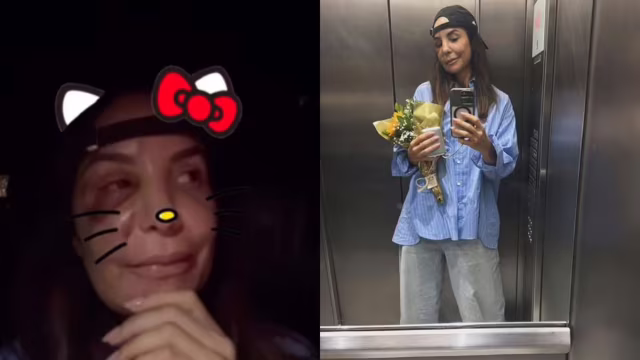 Ivete Sangalo recebe alta após cirurgia no rosto e diz que turnê está mantida