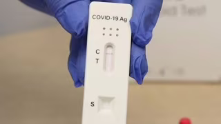 Minas Gerais registra 3.333 casos de Covid-19 nos dois primeiros meses de 2026