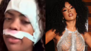 Cantora Marvvila passa por cirurgia após diagnóstico de tumor na orelha