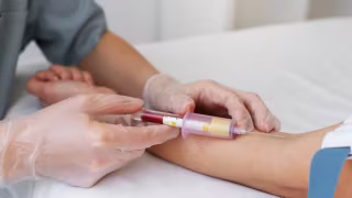 SUS incorpora teste rápido para diagnóstico de dengue