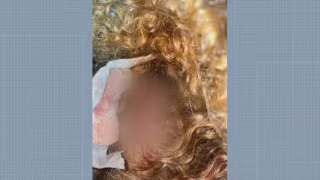 Mulher é agredida após recusar cantada na saída de festa em Rocha Miranda