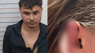 Homem puxa cabelo e arranca pedaço da orelha de mulher com mordida em restaurante de Piracaia