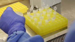 São Paulo confirma 2º caso importado de sarampo em 2026