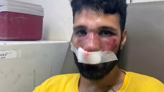 DJ diz ter sido espancado por entregadores após ser confundido com ladrão de bicicleta no Catete