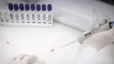 Caso suspeito de ebola em paciente internado em São Paulo é descartado após exames