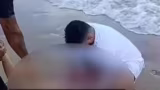 Jovem de 19 anos fica gravemente ferida após ataque de tubarão em Boa Viagem, no Recife