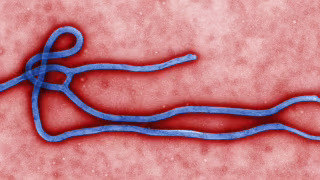 Exame da Fiocruz descarta Ebola em paciente atendido em Novo Hamburgo (RS)