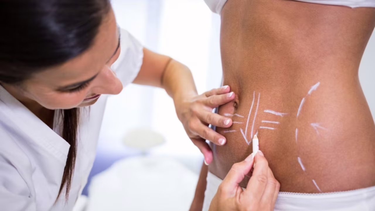 Mulher apresentou inflamações, abertura dos pontos e necrose
