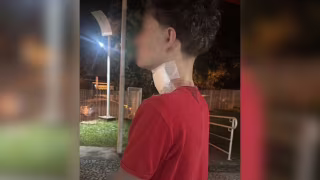 Motociclista leva 35 pontos no pescoço após ser atingido por linha com cerol em Rio Preto