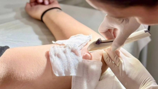 Timóteo capacita rede de saúde para inserção de Implanon e prepara oferta de DIU hormonal