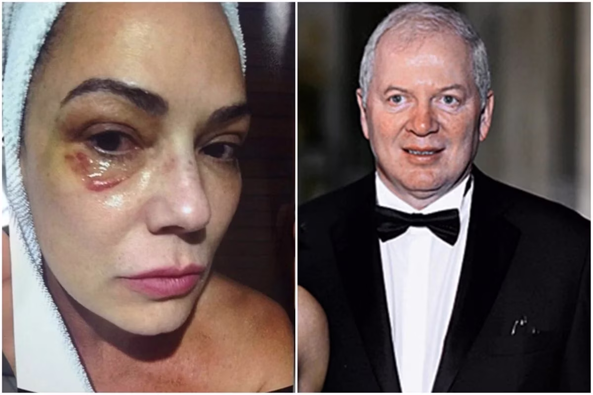 O empresário Lírio Parisotto recebeu uma condenação em primeira instância por agredir a ex-modelo Luiza Brunet