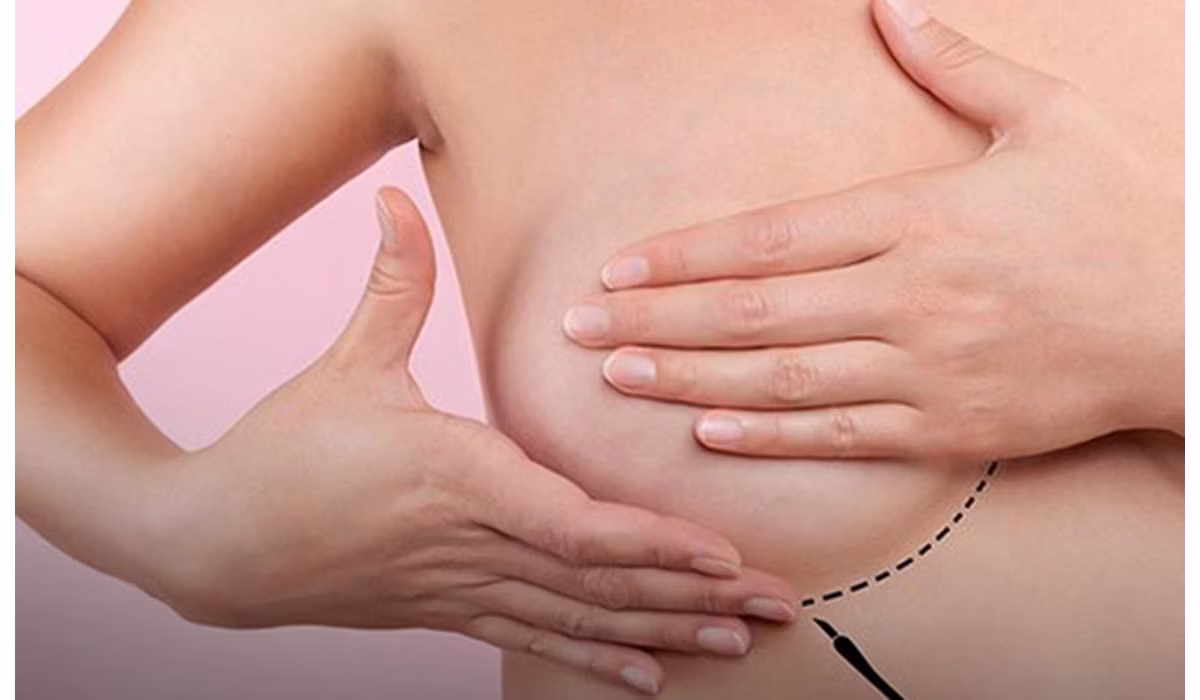 Pessoas diagnosticadas com câncer de mama podem obter isenção do Imposto de Renda sobre a quantia recebida de aposentadoria