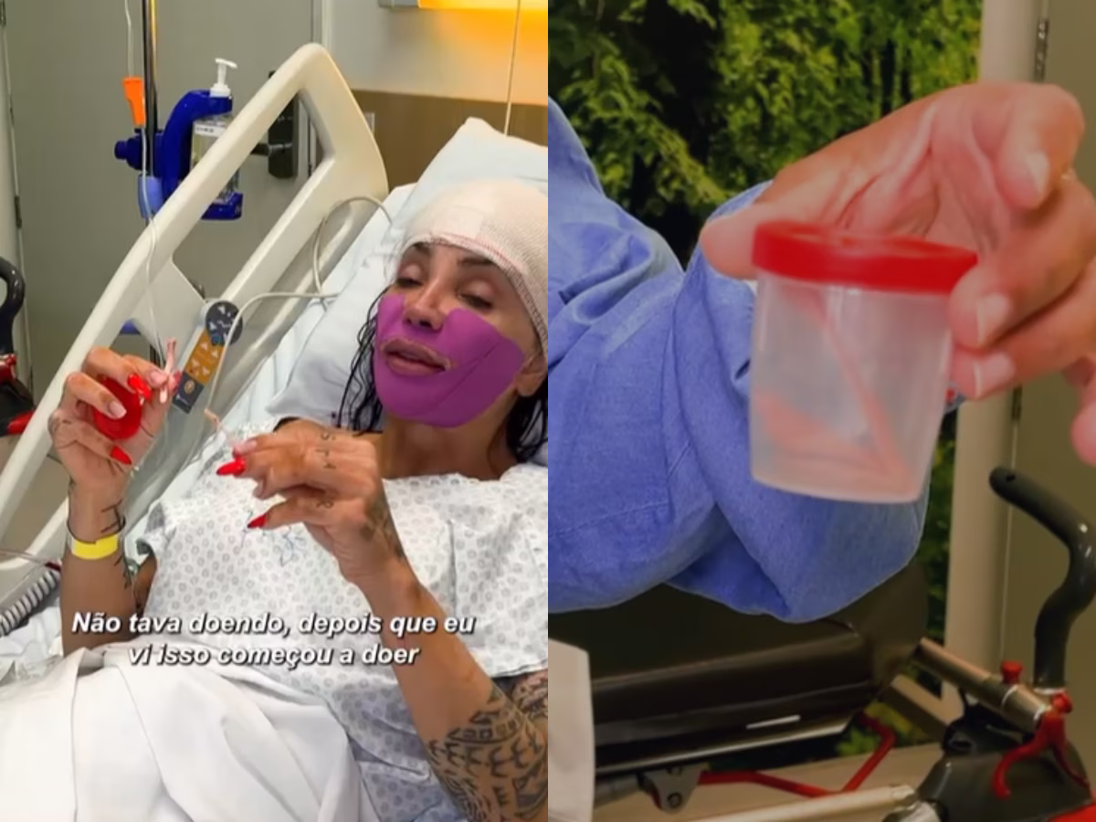 Maya Massafera realiza procedimento cirúrgico para suavizar traços faciais