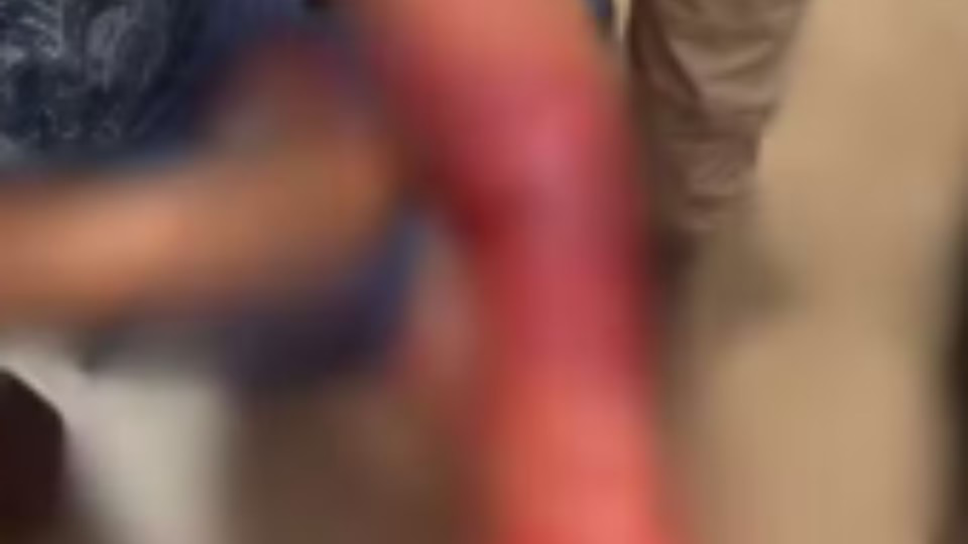 Conforme registrado pela Polícia Militar, a autora, ao perder o controle emocional, ficou irritada e agrediu o homem no braço com uma faca.