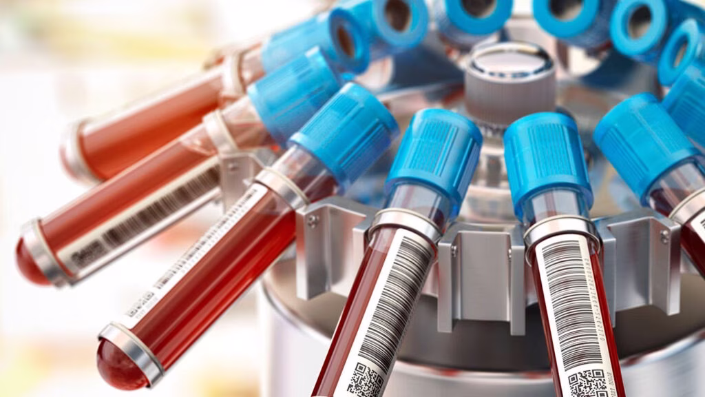 Pesquisa aponta para novos testes na previsão do risco cardiovascular para além dos níveis de colesterol