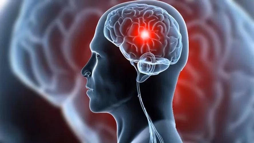 Profissionais da saúde ressaltam que identificar os sinais iniciais do AVC pode prevenir sequelas severas e melhorar as possibilidades de recuperação