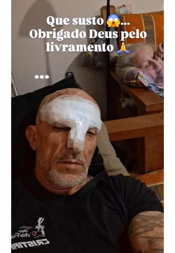 Cristian Cravinhos sofre 12 pontos na cabeça após grave acidente de motocicleta