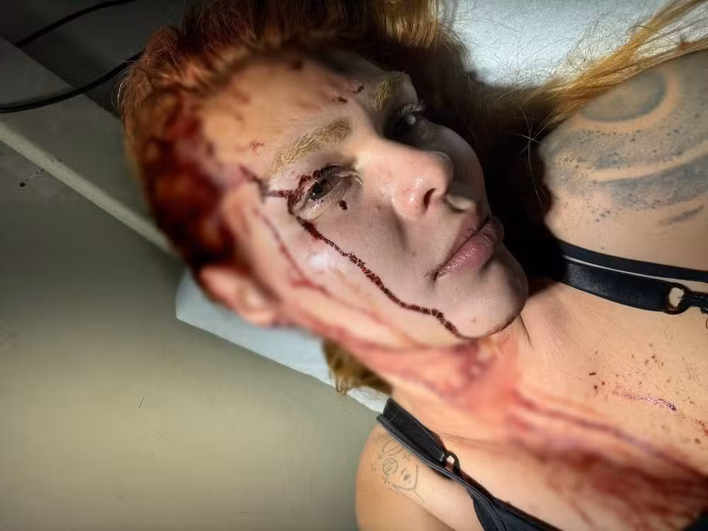 Adolescente sofreu ataque com um facão