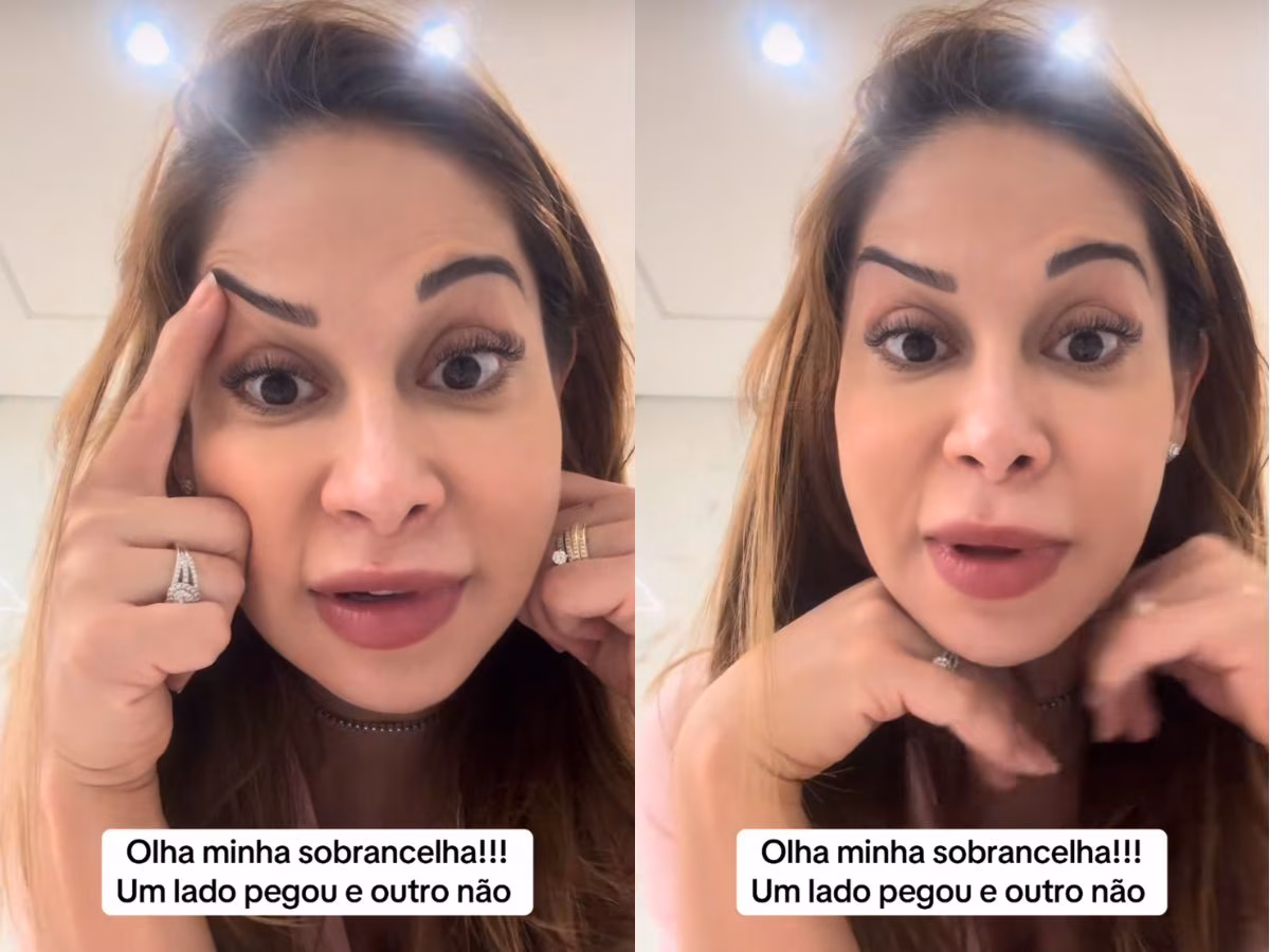 Maíra Cardi entra em desespero após botox deixar sobrancelhas assimétricas: “Cara endemoniada”
