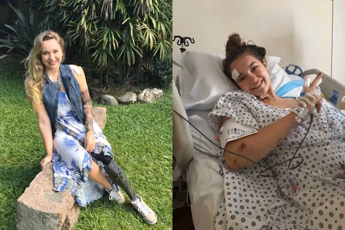 Turista brasileira sofreu amputações de um braço e uma perna após ser atropelada por um trem do metrô de Nova York em 2016