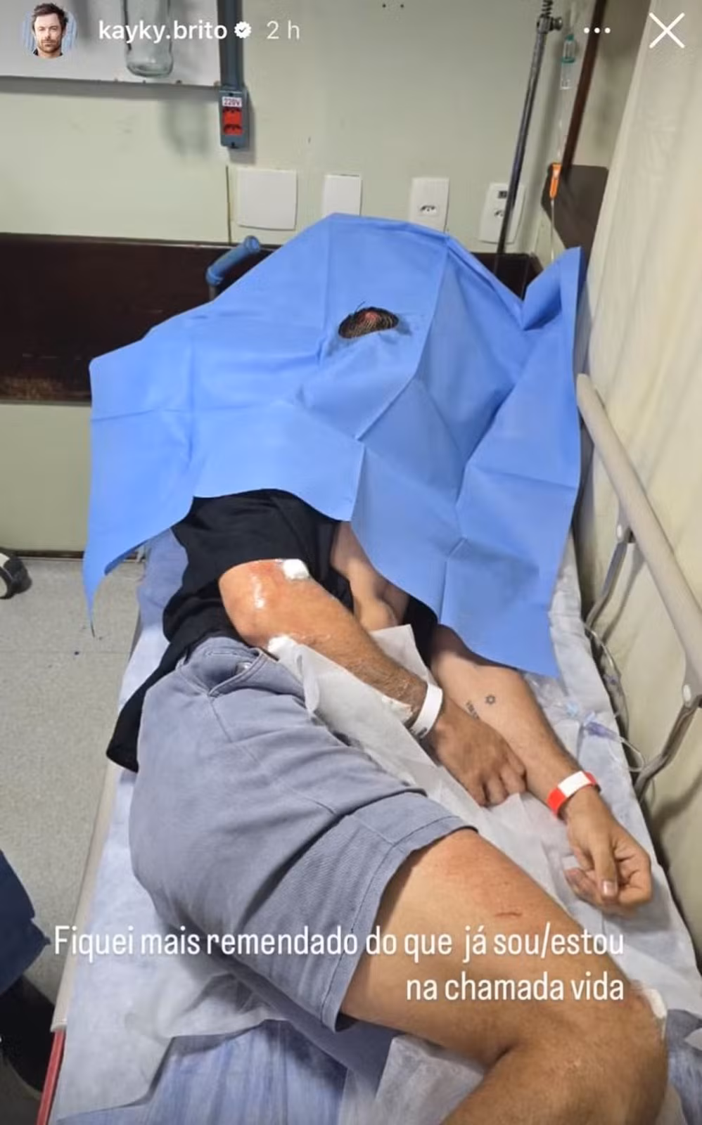 O ator de 37 anos relata que caiu na tarde desta quarta-feira por causa de um buraco