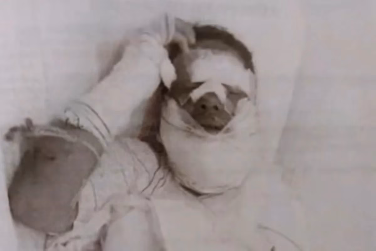 O homem já tinha antecedentes de agressão contra uma ex-companheira e incendiou a atual esposa após uma discussão