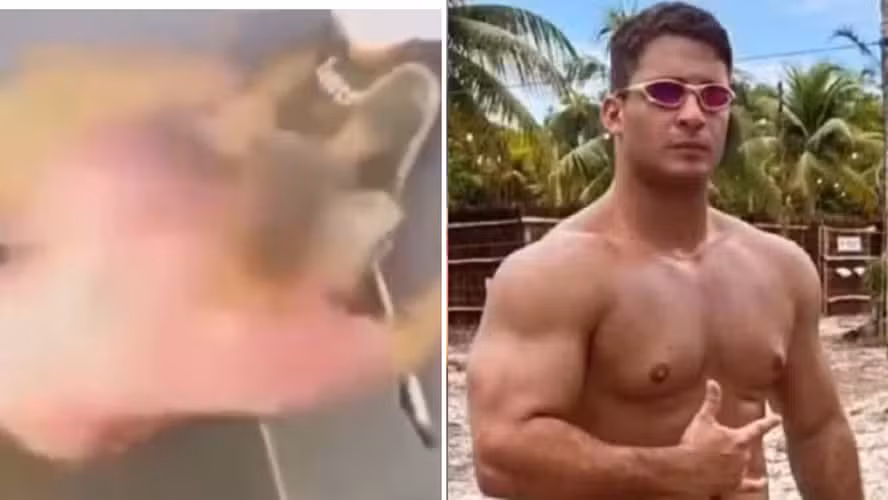 Número de casos é preocupante