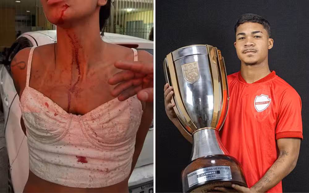 Mulher denuncia ter sido agredida por jogador do Vila Nova no Rio de Janeiro