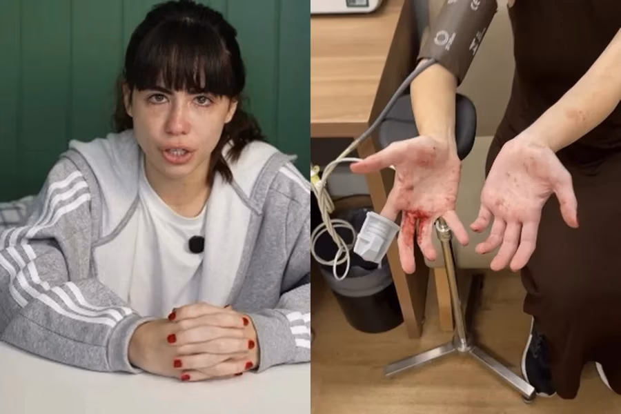 A atriz e influenciadora Nina Baiocchi contou na noite dessa quinta-feira (15/1) que ficou machucada após reagir a um assalto em SP